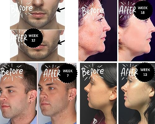 GUMBELLS™- JAW & FACE EXERCISER 12XHardGum - Trainer Kit for MEN and WOMAN – exerciser to strengthen & define your Jawline, Face, Mouth & Jawrz.